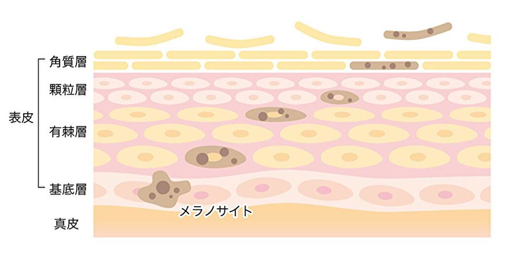医師監修 シミが消える仕組みとは 前兆はある タイプ別の適切なケアと対策 Vitabridc12 Beauty