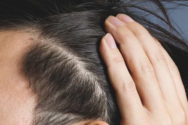 医師監修 秋冬に抜け毛は３倍増える 理由と対策をご紹介 Vitabridc12 Hair