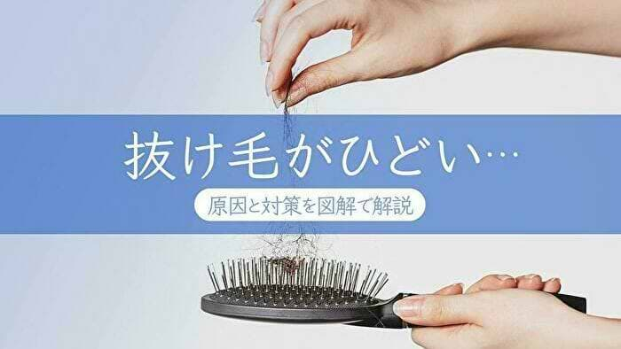 医師監修 抜け毛がひどいとお悩みの男性 女性必見 原因と対策 図解 Vitabridc12 Hair