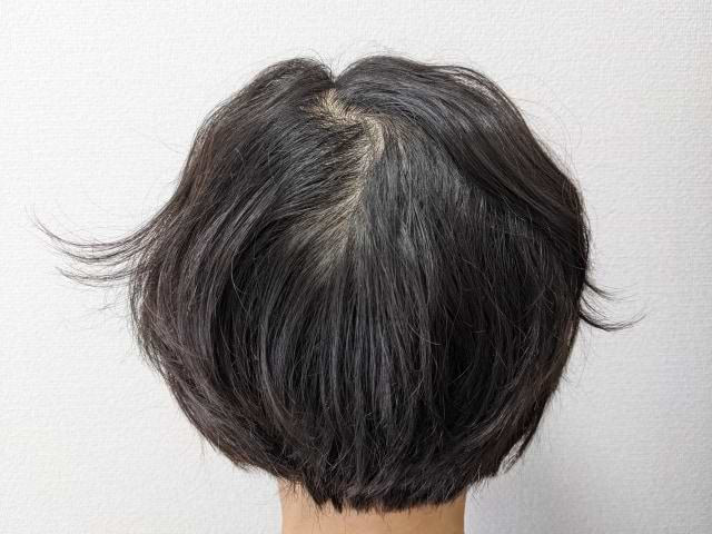 医師監修 つむじはげの基準ってどこから 見分け方や改善対策を解説 Vitabridc12 Hair